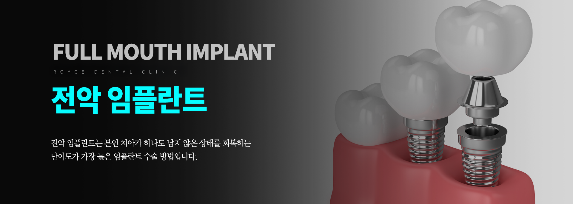 tooth_01